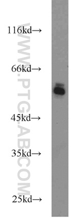 KGA/GAM/GAC Antibody in Western Blot (WB)