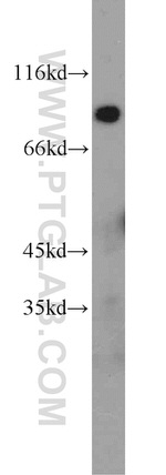 KGA/GAM/GAC Antibody in Western Blot (WB)