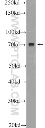 VSX1 Antibody in Western Blot (WB)