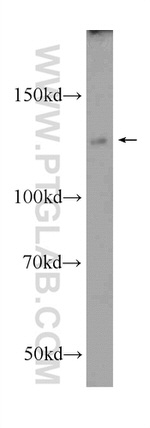 NFKB1 Antibody in Western Blot (WB)