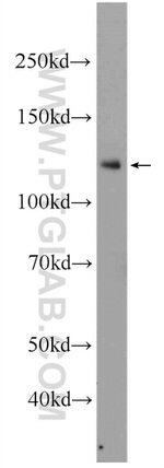 NFKB1 Antibody in Western Blot (WB)