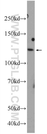 NFKB1 Antibody in Western Blot (WB)