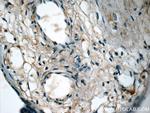 NFKB1 Antibody in Immunohistochemistry (Paraffin) (IHC (P))