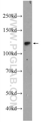 NFKB1 Antibody in Western Blot (WB)