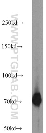 GRB10 Antibody in Western Blot (WB)