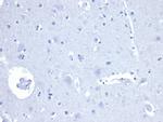 AMACR/p504S Antibody in Immunohistochemistry (Paraffin) (IHC (P))