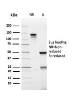 AMACR/p504S Antibody in SDS-PAGE (SDS-PAGE)