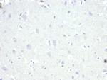 AMACR/p504S (Prostate Cancer Marker) Antibody in Immunohistochemistry (Paraffin) (IHC (P))