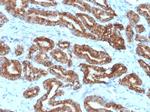 AMACR/p504S (Prostate Cancer Marker) Antibody in Immunohistochemistry (Paraffin) (IHC (P))