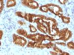 AMACR/p504S (Prostate Cancer Marker) Antibody in Immunohistochemistry (Paraffin) (IHC (P))