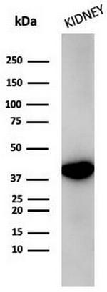 AMACR/p504S (Prostate Cancer Marker) Antibody in Western Blot (WB)