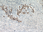 MUC1/CA15-3 Antibody in Immunohistochemistry (Paraffin) (IHC (P))