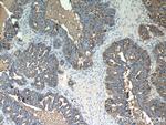 MUC1/CA15-3 Antibody in Immunohistochemistry (Paraffin) (IHC (P))