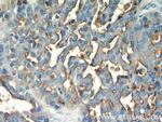 MUC1/CA15-3 Antibody in Immunohistochemistry (Paraffin) (IHC (P))