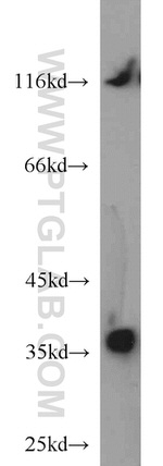 P15RS Antibody in Western Blot (WB)