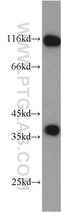 P15RS Antibody in Western Blot (WB)