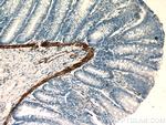 alpha Actin Antibody in Immunohistochemistry (Paraffin) (IHC (P))