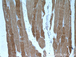 alpha Actin Antibody in Immunohistochemistry (Paraffin) (IHC (P))