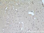 UCP1 Antibody in Immunohistochemistry (Paraffin) (IHC (P))