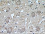 UCP1 Antibody in Immunohistochemistry (Paraffin) (IHC (P))