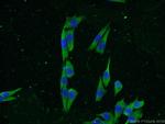 KCNK18 Antibody in Immunocytochemistry (ICC/IF)