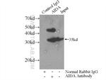 AIDA Antibody in Immunoprecipitation (IP)