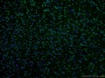 RSK2 Antibody in Immunohistochemistry (PFA fixed) (IHC (PFA))