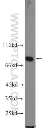 RSK2 Antibody in Western Blot (WB)