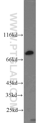 RSK2 Antibody in Western Blot (WB)