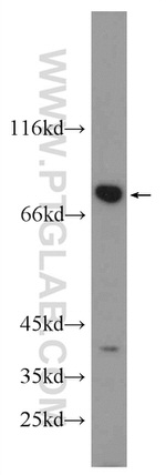 RSK2 Antibody in Western Blot (WB)