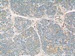 ADAM8 Antibody in Immunohistochemistry (Paraffin) (IHC (P))