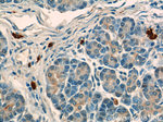 ADAM8 Antibody in Immunohistochemistry (Paraffin) (IHC (P))