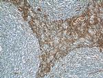 ADAM8 Antibody in Immunohistochemistry (Paraffin) (IHC (P))