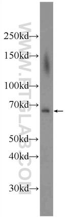 ADAM8 Antibody in Western Blot (WB)