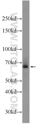 ADAM8 Antibody in Western Blot (WB)