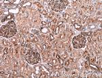 PLXNB1 Antibody in Immunohistochemistry (Paraffin) (IHC (P))