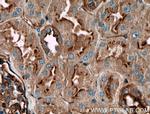 PLXNB1 Antibody in Immunohistochemistry (Paraffin) (IHC (P))