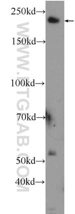 PLXNB1 Antibody in Western Blot (WB)