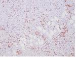 ALK (Anaplastic Lymphoma Kinase)/CD246 Antibody in Immunohistochemistry (Paraffin) (IHC (P))