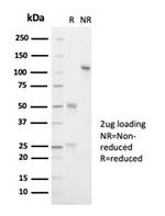 ALK (Anaplastic Lymphoma Kinase)/CD246 Antibody in Immunoelectrophoresis (IE)