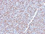 ALK (Anaplastic Lymphoma Kinase)/CD246 Antibody in Immunohistochemistry (Paraffin) (IHC (P))