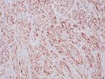 ALK (Anaplastic Lymphoma Kinase)/CD246 Antibody in Immunohistochemistry (Paraffin) (IHC (P))