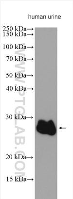 ZG16B Antibody in Western Blot (WB)