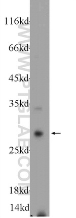 Cathepsin G Antibody in Western Blot (WB)