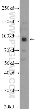 NARG1 Antibody in Western Blot (WB)