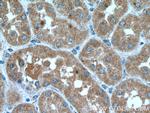 IER2 Antibody in Immunohistochemistry (Paraffin) (IHC (P))