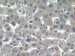 BCHE Antibody in Immunohistochemistry (Paraffin) (IHC (P))