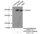 SNRNP200 Antibody in Immunoprecipitation (IP)