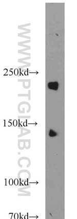 SNRNP200 Antibody in Western Blot (WB)