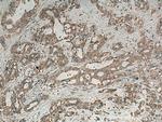 Alpha Internexin Antibody in Immunohistochemistry (Paraffin) (IHC (P))